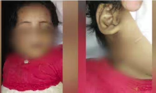 രണ്ടു വയസ്സുകാരിയെ പിതാവ് മർദ്ദിച്ചു കൊലപ്പെടുത്തി രണ്ടു വയസ്സുകാരിയെ പിതാവ് മർദ്ദിച്ചു കൊലപ്പെടുത്തി