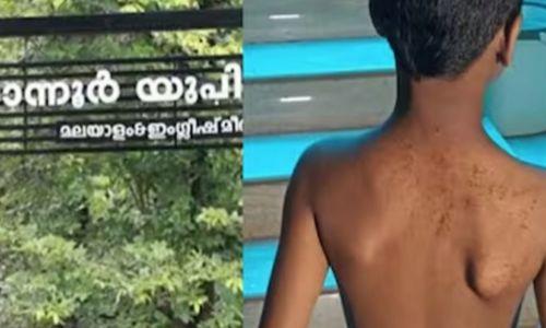 പകർത്തിയെഴുതാൻ വൈകിയതിന് രണ്ടാം ക്ലാസുകാരന് മർദനം; കണ്ണൂരിൽ അധ്യാപകന് സസ്പെൻഷൻ