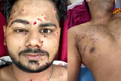 ഡൽഹിയിൽ സമരക്കാർക്ക് നേരെ പെല്ലറ്റ് തോക്കുകൾ ഉപയോഗിച്ചതായി സർക്കാർ സ്ഥിരീകരണം