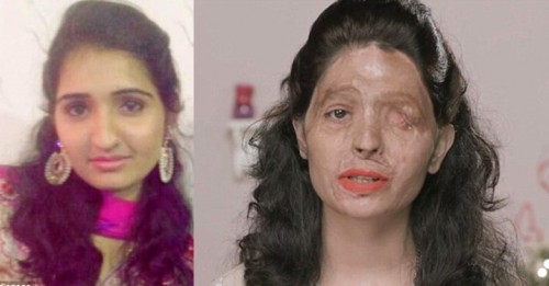 മുഖം നഷ്ടപ്പെട്ട രേഷ്മയുടെ ബ്യൂട്ടി ടിപ്സ് വൈറലാകുന്നു...
