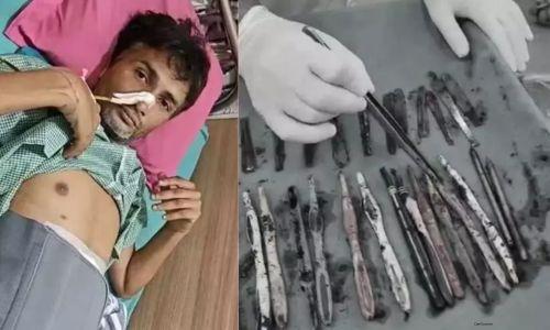 ഡി അഡിക്‌ഷൻ കേന്ദ്രത്തിൽ യുവാവ് സ്പൂണുകളും ട്രൂത്ത് ബ്രഷുകളും പേനയും വിഴുങ്ങി