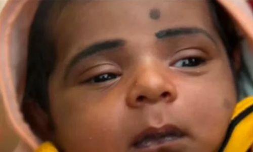 റമ്പൂട്ടാൻ തൊണ്ടയിൽ അഞ്ച് മാസം പ്രായമായ കുഞ്ഞ് മരിച്ചു റമ്പൂട്ടാൻ തൊണ്ടയിൽ അഞ്ച് മാസം പ്രായമായ കുഞ്ഞ് മരിച്ചു
