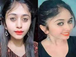 പ്ലാസ്റ്റിക് സർജറി; കന്നഡ നടി മരിച്ചു പ്ലാസ്റ്റിക് സർജറി; കന്നഡ നടി മരിച്ചു