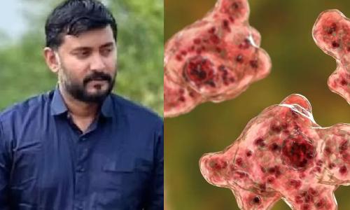 കോഴിക്കോട് വീണ്ടും അമീബിക് മസ്തിഷ്‌കജ്വര മരണം; മലപ്പുറം സ്വദേശി ചികിത്സയിലിരിക്കെ മരിച്ചു