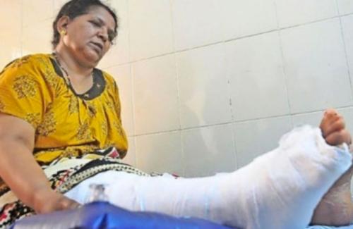 കാലുമാറി ശസ്ത്രക്രിയ നടത്തിയ സംഭവത്തിൽ ഡോക്ടര്ക്ക് വീഴ്ചയെന്ന് ആരോഗ്യ വകുപ്പിന്റെ റിപ്പോര്ട്ട് കാലുമാറി ശസ്ത്രക്രിയ നടത്തിയ സംഭവത്തിൽ ഡോക്ടര്ക്ക് വീഴ്ചയെന്ന് ആരോഗ്യ വകുപ്പിന്റെ റിപ്പോര്ട്ട്