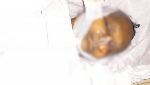 ആശുപത്രി മോർച്ചറിയിൽ മൃതദേഹം എലി കരണ്ട നിലയിൽ