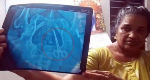 ഉഷയുടെ വയറ്റിൽ നിന്ന് കത്രിക പുറത്തെടുത്തു; ചികിത്സാപിഴവിൽ ആരോഗ്യവകുപ്പിന്റെ നടപടി