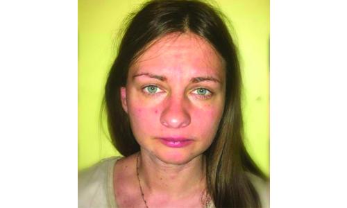 ലി­ഗ മരി­ച്ചത് ശ്വാ­സംമു­ട്ടി­യാ­കാ­മെ­ന്ന് ഡോ­ക്ടർ‍­മാ­ർ