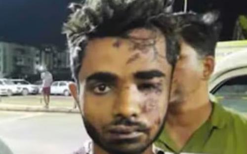 ട്രെയിൻ തീവയ്പ് കേസ്; പ്രതിയുടെ റിമാൻഡ് നീട്ടി ട്രെയിൻ തീവയ്പ് കേസ്; പ്രതിയുടെ റിമാൻഡ് നീട്ടി