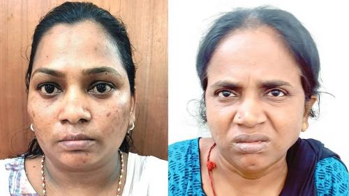 മൂവാറ്റുപുഴയിൽ കിടപ്പുരോഗിയുടെ 10 പവൻ കവർന്ന ഹോം നഴ്‌സും സുഹൃത്തും പിടിയിൽ; മോഷണം ആൺവേഷം കെട്ടി