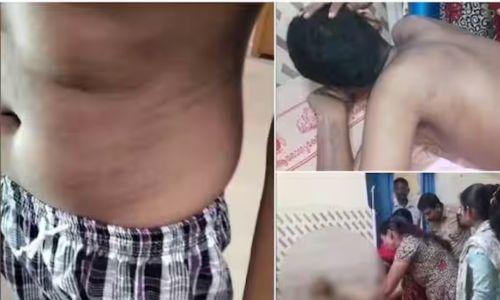 ഭിന്നശേഷിക്കാരന് 16കാരന് സംരക്ഷണകേന്ദ്രത്തിൽ ക്രൂര മര്ദനം ഭിന്നശേഷിക്കാരന് 16കാരന് സംരക്ഷണകേന്ദ്രത്തിൽ ക്രൂര മര്ദനം