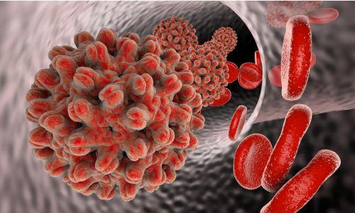 വൈറൽ ഹെപറ്റൈറ്റിസ്; മലപ്പുറം ജില്ലയിൽ ഒരാൾകൂടി മരിച്ചു