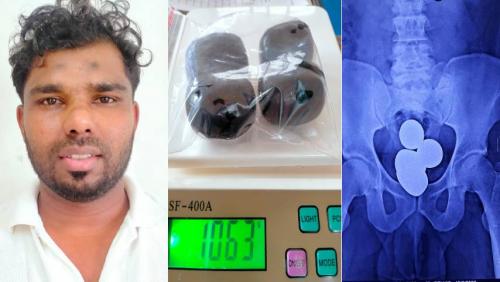 വയറ്റിൽ ഒരു കിലോയിൽ അധികം സ്വർണ്ണം; ദുബായിൽ നിന്നെത്തിയ യുവാവ് കരിപ്പൂർ വിമാനത്താവളത്തിൽ പിടിയിൽ വയറ്റിൽ ഒരു കിലോയിൽ അധികം സ്വർണ്ണം; ദുബായിൽ നിന്നെത്തിയ യുവാവ് കരിപ്പൂർ വിമാനത്താവളത്തിൽ പിടിയിൽ