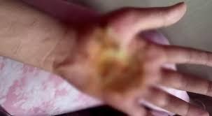 തൃക്കാക്കരയിൽ ട്രാൻസ്ജെൻഡർ യുവതിക്ക് നേരെ ആക്രമണം തൃക്കാക്കരയിൽ ട്രാൻസ്ജെൻഡർ യുവതിക്ക് നേരെ ആക്രമണം