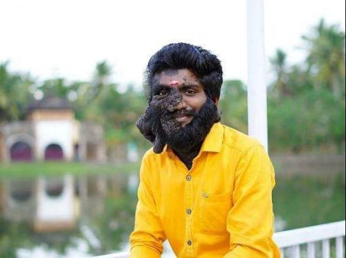 അപൂര്വ്വ രോഗത്തോട് പടവെട്ടി; പ്രഭുലാല് പ്രസന്നന് അന്തരിച്ചു അപൂര്വ്വ രോഗത്തോട് പടവെട്ടി; പ്രഭുലാല് പ്രസന്നന് അന്തരിച്ചു