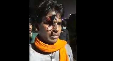 ഹെൽമറ്റ് ധരിക്കാത്തതിന് യുവാവിന്റെ നെറ്റിയിൽ താക്കോൽ കുത്തിക്കയറ്റി പോലീസ്   