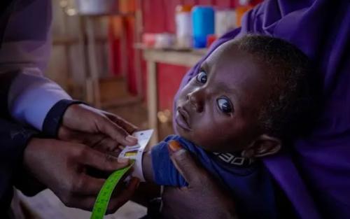 സൊമാലിയയിൽ പട്ടിണി രൂക്ഷമാകുന്നു; അടിയന്തര മുന്നറിയിപ്പുമായി യൂണിസെഫ്