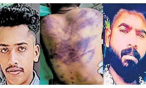 വളര്‍ത്തു നായയ്ക്ക് തീറ്റ നല്‍കാന്‍ വൈകിയതിന് യുവാവിനെ തല്ലികൊന്നു