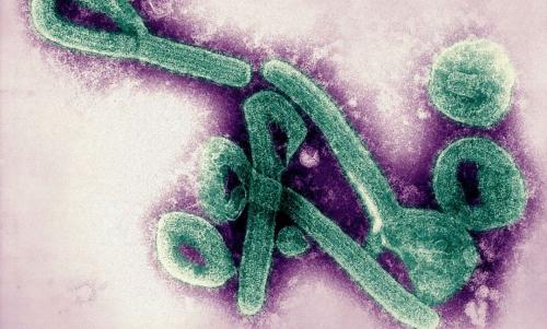 ഇക്വറ്റോറിയൽ ഗിനിയയിൽ മാർബർഗ് വൈറസ്; 9 മരണം