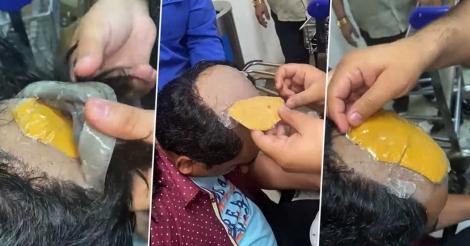 വിഗ്ഗിനടിയിൽ ഒളിപ്പിച്ച് സ്വർണക്കടത്ത്; ഡൽഹി വിമാനത്താവളത്തിൽ യാത്രക്കാരൻ പിടിയിൽ വിഗ്ഗിനടിയിൽ ഒളിപ്പിച്ച് സ്വർണക്കടത്ത്; ഡൽഹി വിമാനത്താവളത്തിൽ യാത്രക്കാരൻ പിടിയിൽ
