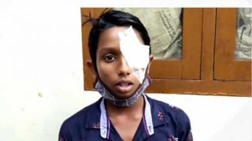 കുട്ടികളെ കളിക്കാൻ വിളിച്ചുകൊണ്ടുപോയതിന് 14 കാരന് അയൽവാസിയുടെ ക്രൂരമർദ്ദനം കുട്ടികളെ കളിക്കാൻ വിളിച്ചുകൊണ്ടുപോയതിന് 14 കാരന് അയൽവാസിയുടെ ക്രൂരമർദ്ദനം