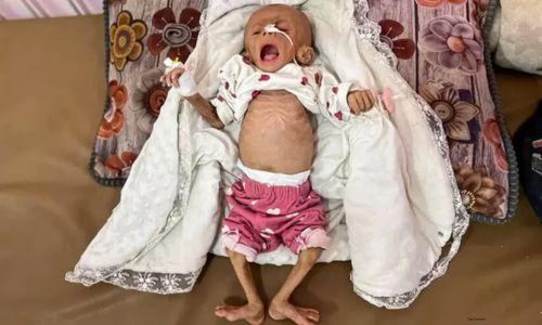 ഗസ്സയിലെ ക്രൂരത; മെഡിക്കൽ എത്തിക്‌സിന്റെയും അന്താരാഷ്ട്ര നിയമങ്ങളുടെയും ഗുരുതര ലംഘനമെന്ന് ഇസ്രായേൽ മെഡിക്കൽ അസോസിയേഷൻ
