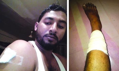 തെ­രുവ് നാ­യയു­ടെ­ ആക്രമണം : ബംഗ്ലാ­ദേശ് സ്വദേ­ശി­ക്ക് ഗു­രു­തരമാ­യി­ പരി­ക്കേ­റ്റു­