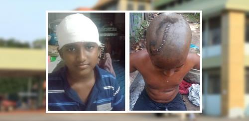 തലയ്ക്കു പരിക്കേറ്റ കുട്ടിയുടെ തലമുടി നീക്കം ചെയ്യാതെ മുറിവിൽ സ്റ്റാപ്ലർ അടിച്ചുവിട്ടു; ആലപ്പുഴ വണ്ടാനം മെഡിക്കൽ കോളേജിനെതിരെ പരാതിയുമായി പിതാവ് തലയ്ക്കു പരിക്കേറ്റ കുട്ടിയുടെ തലമുടി നീക്കം ചെയ്യാതെ മുറിവിൽ സ്റ്റാപ്ലർ അടിച്ചുവിട്ടു; ആലപ്പുഴ വണ്ടാനം മെഡിക്കൽ കോളേജിനെതിരെ പരാതിയുമായി പിതാവ്