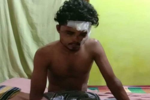തിരുവനന്തപുരത്ത് യുവാവിന് മദ്യപസംഘത്തിന്റെ ക്രൂര മർദ്ദനം; സിസിടിവി ദൃശ്യം പുറത്ത് തിരുവനന്തപുരത്ത് യുവാവിന് മദ്യപസംഘത്തിന്റെ ക്രൂര മർദ്ദനം; സിസിടിവി ദൃശ്യം പുറത്ത്