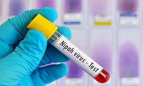 കഴിഞ്ഞ ദിവസം മരിച്ച 24കാരന് നിപ സ്ഥിരീകരിച്ചു; 151 പേർ സമ്പർക്ക പട്ടികയിൽ കഴിഞ്ഞ ദിവസം മരിച്ച 24കാരന് നിപ സ്ഥിരീകരിച്ചു; 151 പേർ സമ്പർക്ക പട്ടികയിൽ