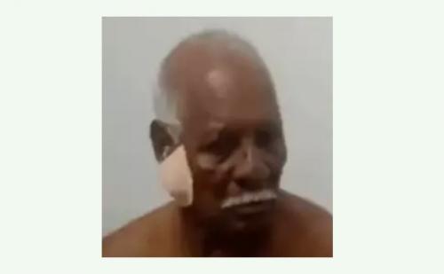 ഫോർട്ടുകൊച്ചിയിൽ മത്സ്യത്തൊഴിലാളിക്ക് കടലിൽ വച്ച് വെടിയേറ്റു ഫോർട്ടുകൊച്ചിയിൽ മത്സ്യത്തൊഴിലാളിക്ക് കടലിൽ വച്ച് വെടിയേറ്റു